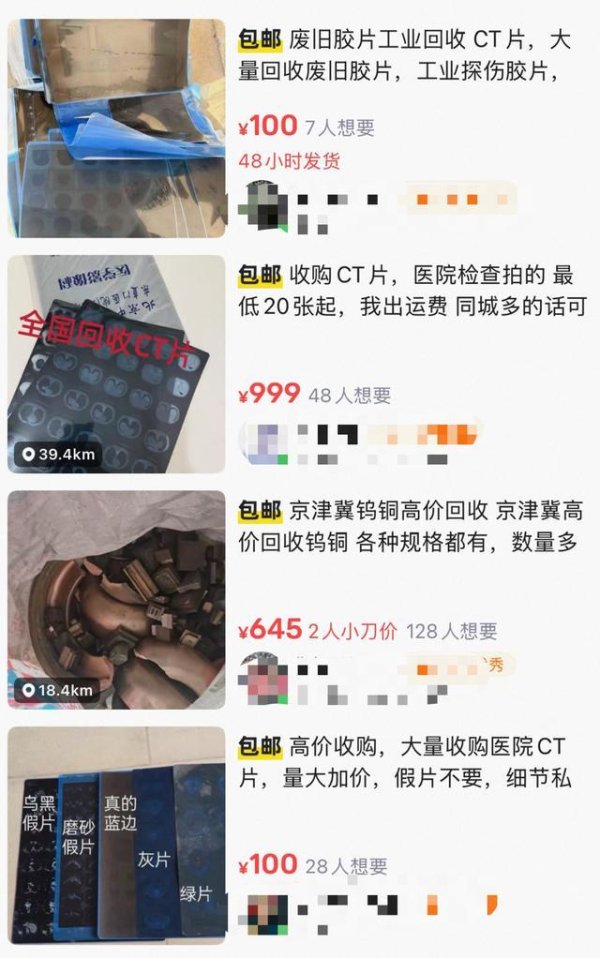 老牌配资平台 高价回收废旧CT片炼银？紧急提醒